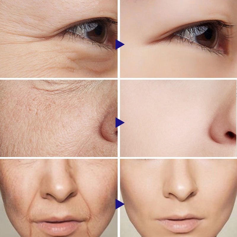Vitamin C Serum Facial Serum Amazon - Image 3