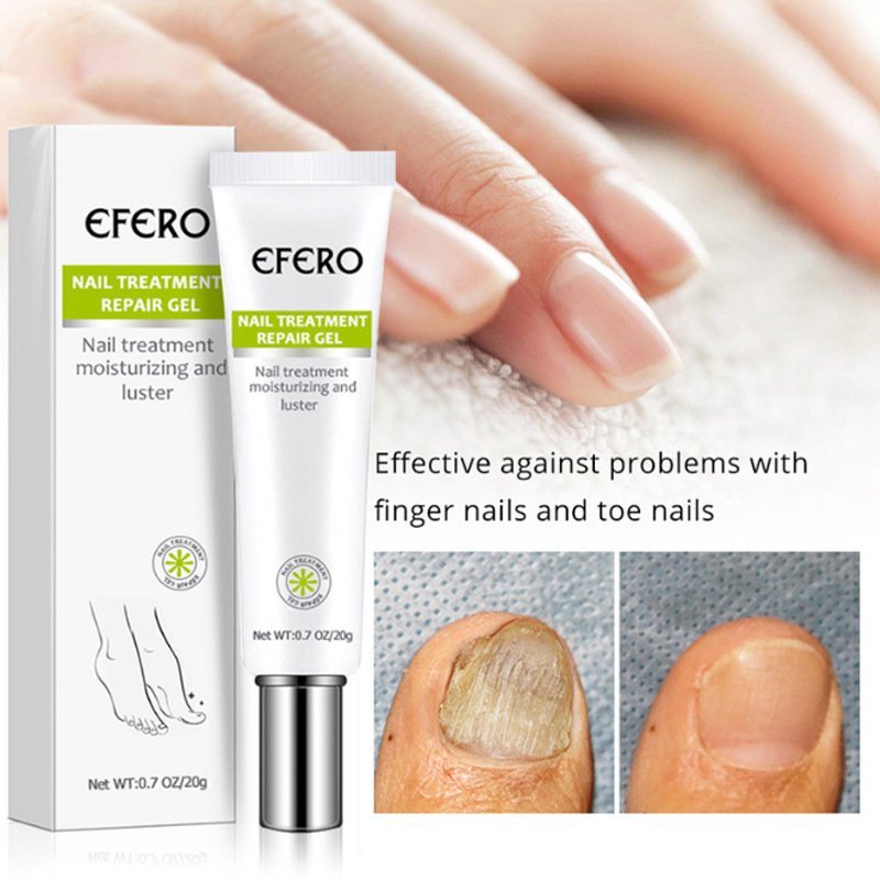 Nail Treatment Serum Nail Foot Nail Fungus Removal Gel Anti Infection Onychomycosis Nail Repair Essence Cream Feet Care - Image 5